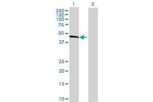 Lane 1: SULT2B1 transfected lysate ( 40.