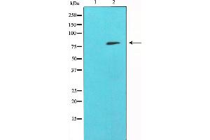 Western blot analysis of SYK expression in whole cell lysates,The lane on the left is treated with the antigen-specific peptide. (SYK antibody)