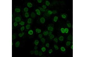 IF analysis of hnRNP D/AUF1/HNRNPD using anti-hnRNP D/AUF1/HNRNPD antibody (ABIN7602592).