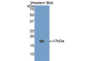 Western Blotting (WB) image for anti-Dymeclin (DYM) (AA 546-669) antibody (ABIN1111113)