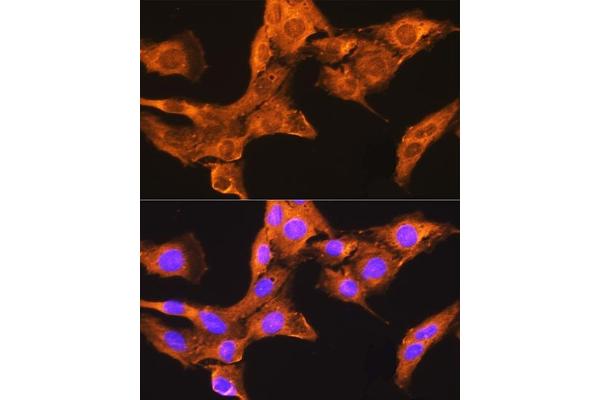 CDV3 antibody