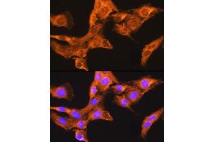 Immunofluorescence analysis of L929 cells using CDV3 Rabbit pAb (ABIN7266240) at dilution of 1:100. (CDV3 antibody)