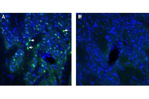 Expression of ADAM23 in rat striatum.