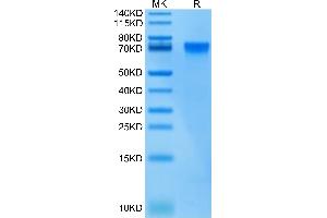 Biotinylated Human LILRB2 on Tris-Bis PAGE under reduced condition. (LILRB2 Protein (His-Avi Tag,Biotin))