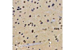 Immunohistochemical analysis of ATIC staining in rat brain formalin fixed paraffin embedded tissue section. (ATIC antibody)