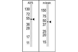 Image no. 1 for anti-Hypoxia Inducible Factor 1, alpha Subunit Inhibitor (HIF1AN) (C-Term) antibody (ABIN356560) (HIF1AN antibody  (C-Term))