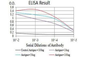Black line: Control Antigen (100 ng),Purple line: Antigen (10 ng), Blue line: Antigen (50 ng), Red line:Antigen (100 ng) (P2RY8 antibody)