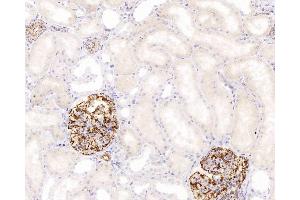 Immunohistochemistry analysis of paraffin-embedded human kidney using NES Monoclonal Antibody at dilution of 1:400. (Nestin antibody)