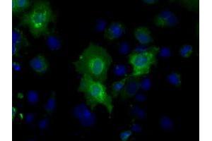 Image no. 5 for anti-Basigin (Ok Blood Group) (BSG) antibody (ABIN1498013) (CD147 antibody)