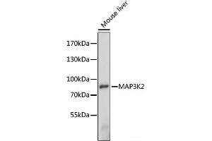 Western blot analysis of extracts of Mouse liver using MAP3K2 Polyclonal Antibody at dilution of 1:1000. (MAP3K2 antibody)