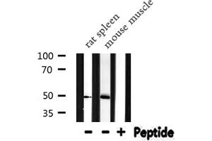 Western blot analysis of IL13RA2 expression in various lysates (IL13RA2 antibody  (C-Term))