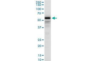 PDLIM5 polyclonal antibody (A02), Lot # NNR0051021QC01. (PDLIM5 antibody  (AA 1-596))