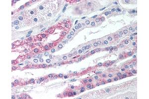 Anti-TGR5 antibody IHC of human kidney. (GPBAR1 antibody  (Cytoplasmic Domain))
