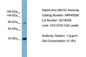 WB Suggested Anti-UNC5C  Antibody Titration: 0. (Unc5c antibody  (Middle Region))