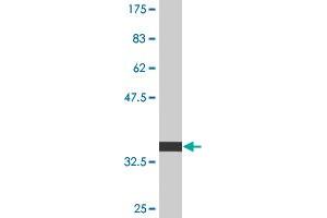 Western Blot detection against Immunogen (35. (IGSF1 antibody  (AA 220-310))