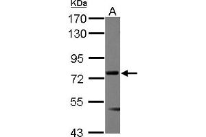 Western Blotting (WB) image for anti-Multiple Endocrine Neoplasia 1 (MEN1) (AA 71-407) antibody (ABIN1499428) (Menin antibody  (AA 71-407))