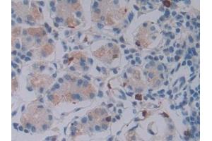 Detection of GZMB in Human Stomach Tissue using Polyclonal Antibody to Granzyme B (GZMB)