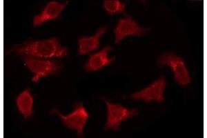 ABIN6277861 staining HeLa by IF/ICC. (FADD antibody  (N-Term))