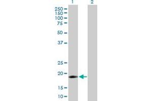 Western Blot analysis of IFNA16 expression in transfected 293T cell line by IFNA16 MaxPab polyclonal antibody. (IFNA16 antibody  (AA 1-189))