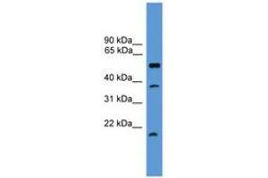 Image no. 1 for anti-serine Peptidase Inhibitor, Kunitz Type, 2 (SPINT2) (AA 91-140) antibody (ABIN6746573) (SPINT2 antibody  (AA 91-140))