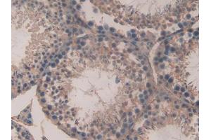 DAB staining on IHC-P; Samples: Mouse Testis Tissue (SPTAN1 antibody  (AA 1605-1806))