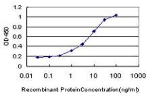 Detection limit for recombinant GST tagged PBX1 is approximately 0. (PBX1 antibody  (AA 213-321))