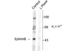 Image no. 1 for anti-Ephrin B1 (EFNB1) (pTyr331) antibody (ABIN372621)