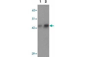 Western blot analysis of AP3M1 in human brain tissue lysate with AP3M1 polyclonal antibody  at (1) 1 and (2) 2 ug/mL.