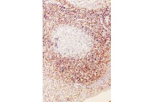Anti-Diubiquitin antibody, IHC(P) IHC(P): Human Tonsil Tissue (UBD antibody  (N-Term))