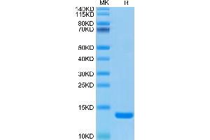 Human B2M on Tris-Bis PAGE under reduced condition. (beta-2 Microglobulin Protein (AA 21-119) (His tag))