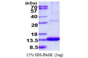 SDS-PAGE (SDS) image for ADP-Ribosylation Factor-Like 9 (ARL9) (AA 1-123) protein (His tag) (ABIN667994)
