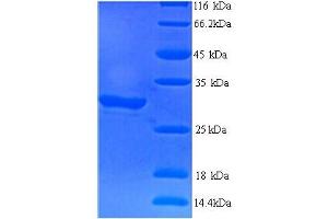SDS-PAGE (SDS) image for Chymotrypsin-Like Elastase Family Member 2a (CEL2A) (AA 29-269) protein (His tag) (ABIN5713348) (CEL2A Protein (AA 29-269) (His tag))
