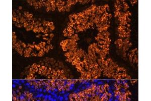 Immunofluorescence analysis of Mouse testis using LDHC Polyclonal Antibody at dilution of 1:100 (40x lens). (Lactate Dehydrogenase C antibody)