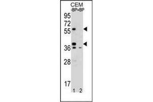 Western blot analysis of MNDA Antibody (N-term) Cat. (MNDA antibody  (N-Term))