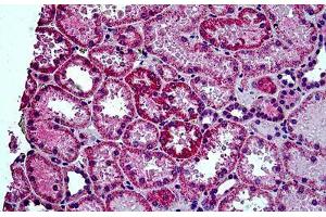 Human Kidney: Formalin-Fixed, Paraffin-Embedded (FFPE) (HYAL2 antibody  (AA 2-12))