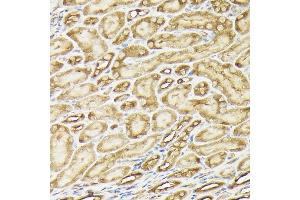 Immunohistochemistry of paraffin-embedded mouse kidney using PIK3CA Rabbit pAb (ABIN6134411, ABIN6145635, ABIN6145637 and ABIN6216129) at dilution of 1:150 (40x lens).