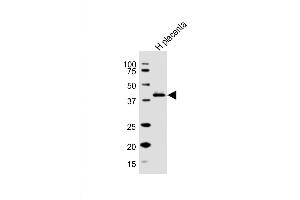 Western Blot at 1:1000 dilution + human placenta lysate Lysates/proteins at 20 ug per lane.