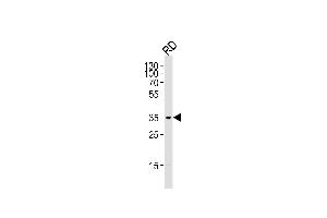 Western blot analysis of lysate from RD cell line,using Cyclin D2 Antibody (Ab-280)(ABIN1450707 and ABIN1450709). (Cyclin D2 antibody)