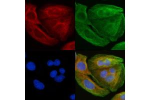 ABIN6257474 and ABIN6276211 staining Hela cells(30 min of UV treatment) by IF/ICC. (Relaxin 3 Receptor 1 antibody  (Internal Region))