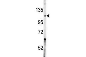 Western blot analysis of c-Abl antibody and A2058 lysate. (ABL1 antibody  (AA 741-769))