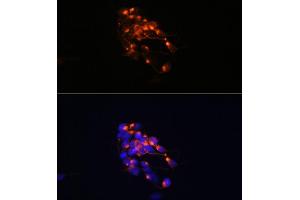 Immunofluorescence analysis of SH-SY5Y cells using Neurofilament M Rabbit mAb (ABIN7268864) at dilution of 1:100 (40x lens). (NEFM antibody)