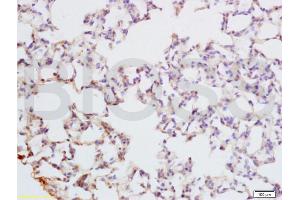 Formalin-fixed and paraffin embedded rat lung tissue labeled with Anti-PAX9 Polyclonal Antibody, Unconjugated (ABIN737691) at 1:200 followed by conjugation to the secondary antibody and DAB staining