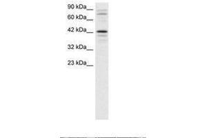 Image no. 1 for anti-SRY (Sex Determining Region Y)-Box 18 (SOX18) (AA 192-241) antibody (ABIN202394) (SOX18 antibody  (AA 192-241))