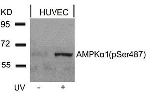 Western blot analysis of extracts from HUVEC cells untreated or treated with UV using AMPKa1(Phospho-Ser487)Antibody. (AMPK alpha antibody  (pSer487))