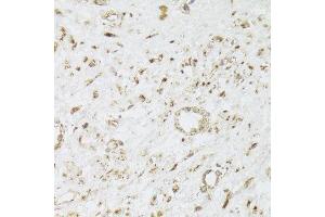 Immunohistochemistry of paraffin-embedded human leiomyoma of uterus using CIAPIN1 Antibody. (CIAPIN1 antibody  (AA 1-312))