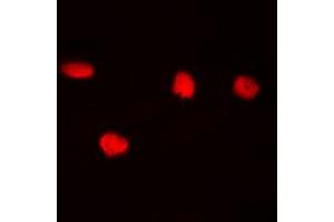 Immunofluorescent analysis of CDC25C (pS216) staining in Hela cells.