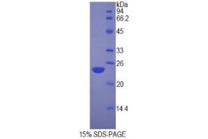 SDS-PAGE (SDS) image for Nucleolin (NCL) (AA 388-569) protein (His tag) (ABIN2126134)