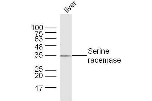 SRR antibody  (AA 1-100)