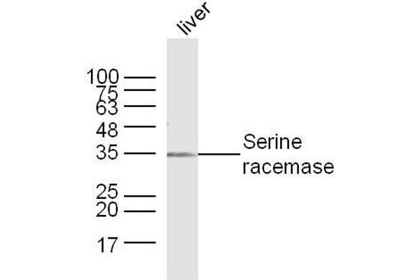 SRR anticorps  (AA 1-100)