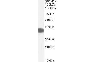 CBR1 antibody  (C-Term)